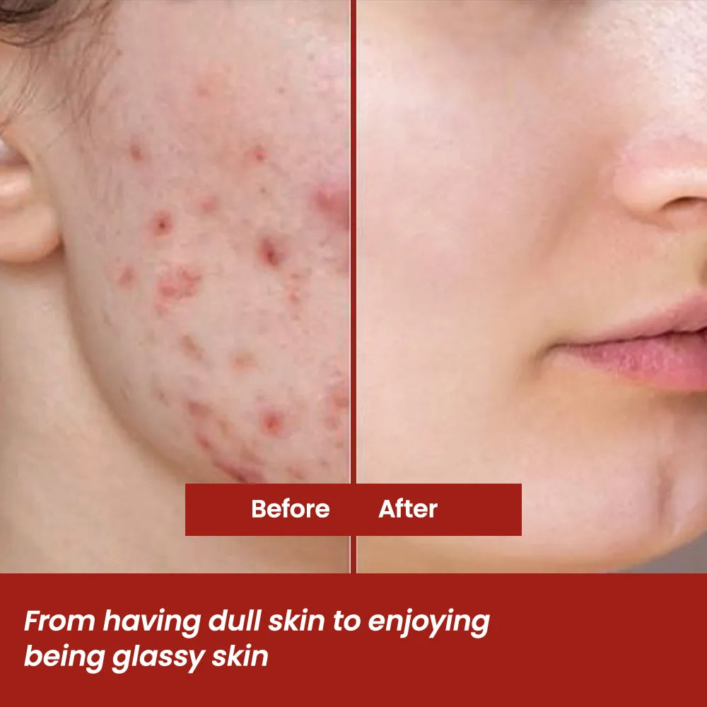 Heme Suddhi Syrup - Reduces Signs of Ageing & Boost Skin Glow